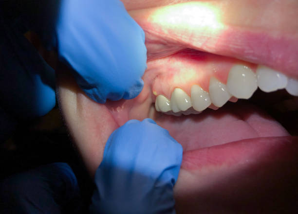 Best Pediatric Emergency Dentist in East Grand Forks, MN