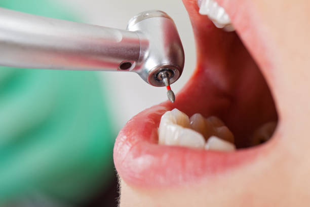 Best Emergency Dental Care for Broken or Chipped Teeth in East Grand Forks, MN